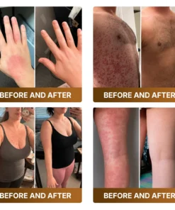 KLENIMORE™ Botox & Bee Venom Advanced Recovery Cream