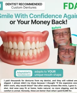 KLENIMORE™ Custom-Fit Smile Support Kit — Strong Suction Feel & Natural-Looking Fit