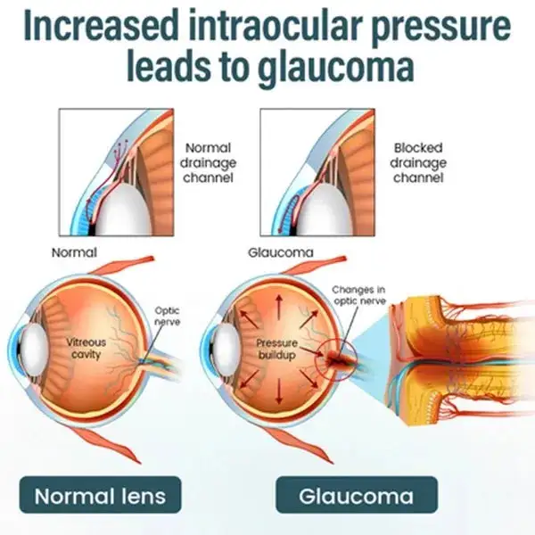 KLENIMORE™ NANO Eye Drops
