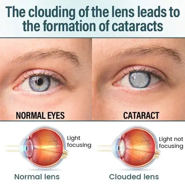 KLENIMORE™ NANO Eye Drops