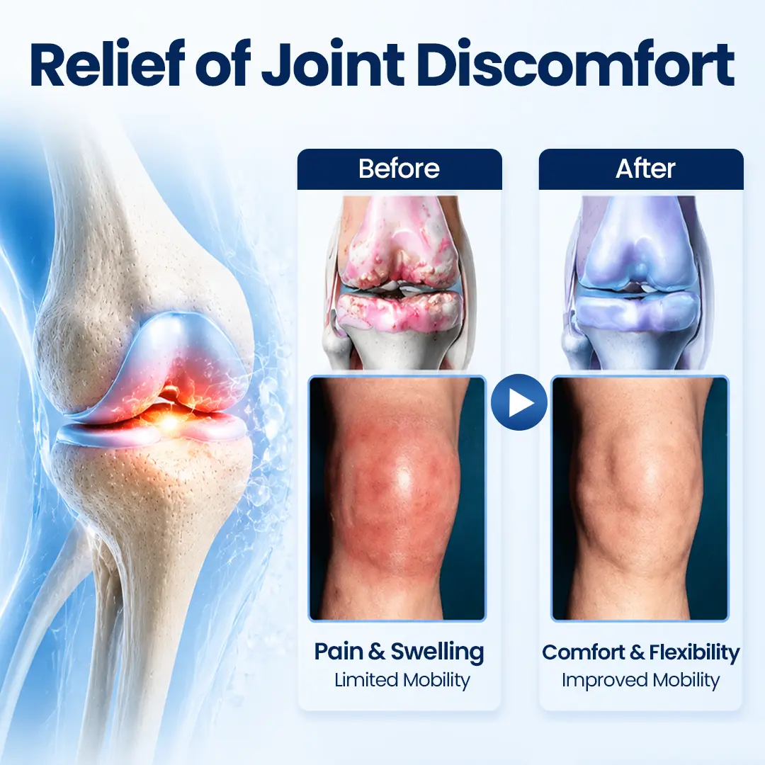 KLENIMORE® ArthriNAD+ Pro Advanced Joint Recovery Cream