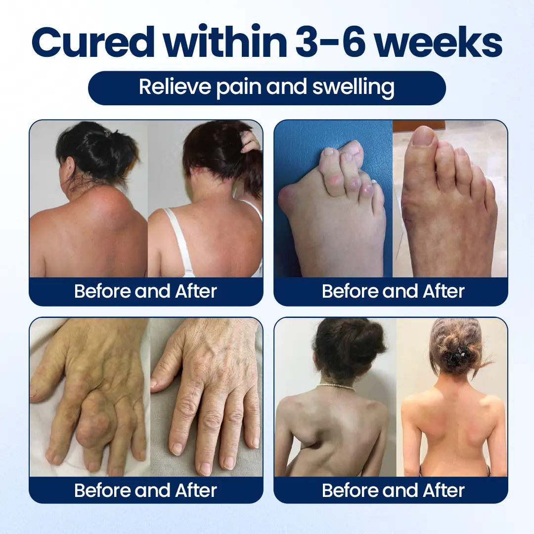 KLENIMORE® ArthriNAD+ Pro Advanced Joint Recovery Cream