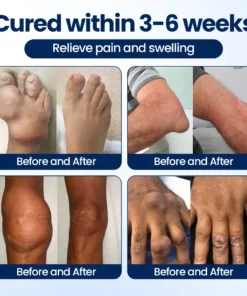 KLENIMORE® ArthriNAD+ Pro Advanced Joint Recovery Cream