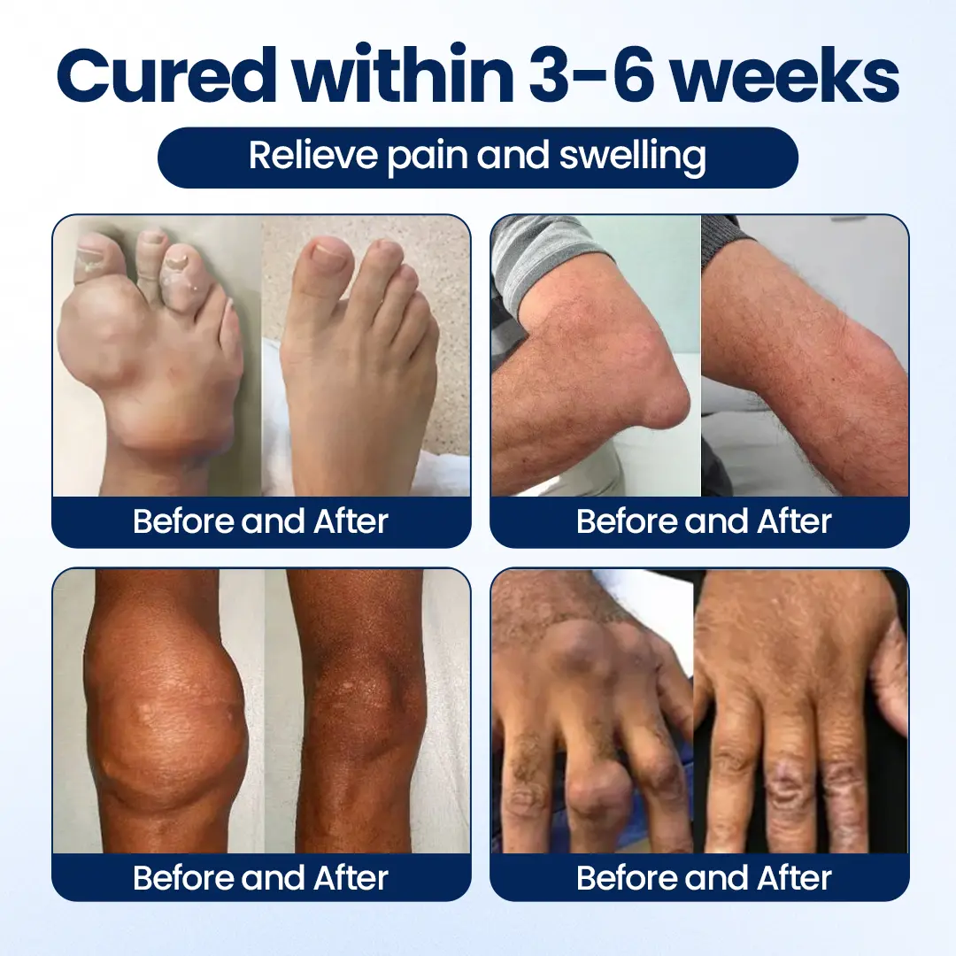 KLENIMORE® ArthriNAD+ Pro Advanced Joint Recovery Cream