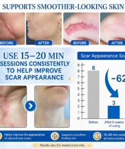 KLENIMORE™ Laser Scar Care Pen