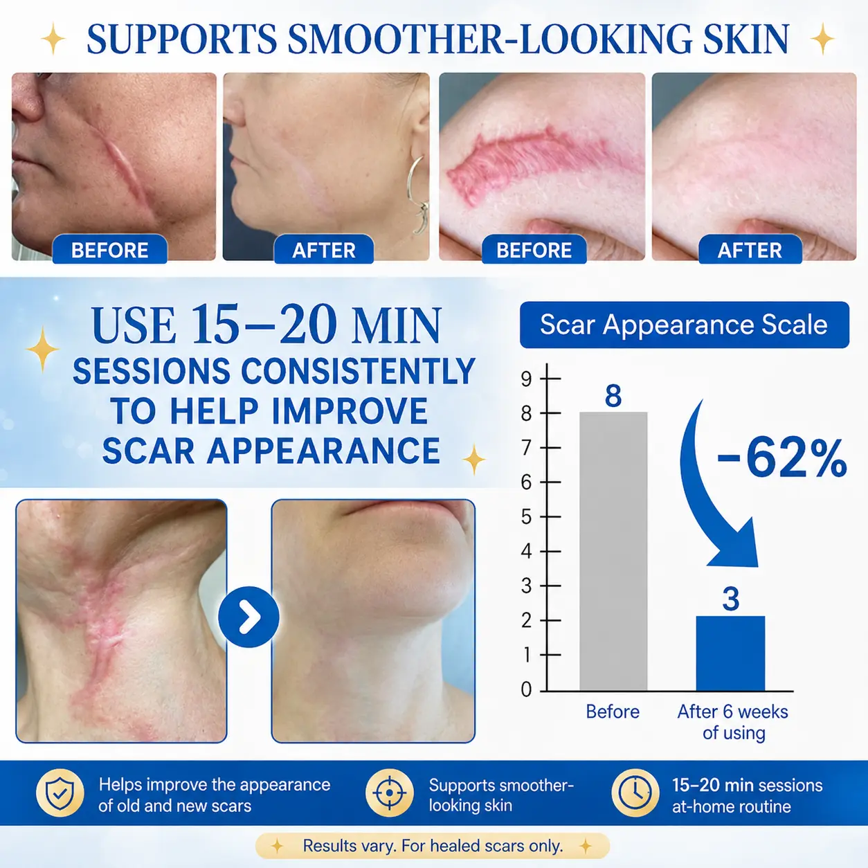 KLENIMORE™ Laser Scar Care Pen