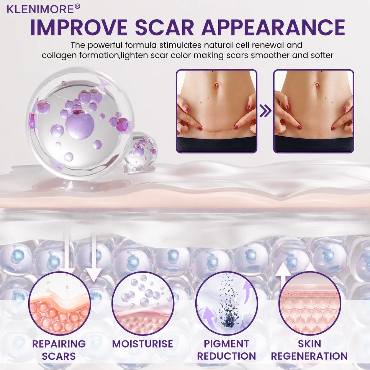 KLENIMORE® ReGenScar Stem Cell Scar Gel