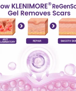 KLENIMORE® ReGenScar Stem Cell Scar Gel