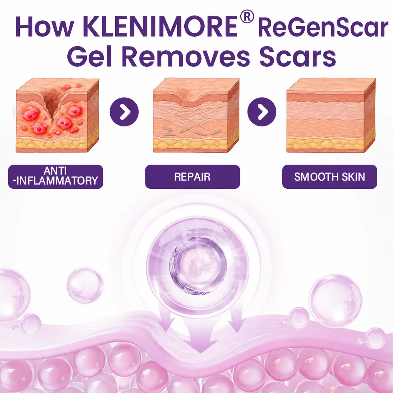 KLENIMORE® ReGenScar Stem Cell Scar Gel