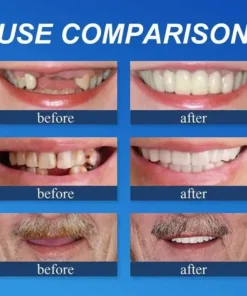 KLENIMORE™ Medical Grade, Strong Adhesion, Custom Fit