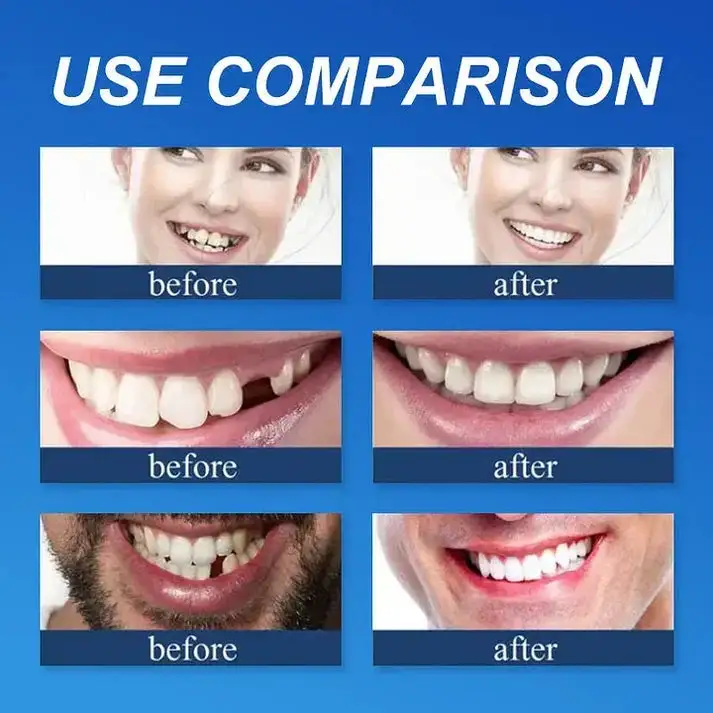 KLENIMORE™ Medical Grade, Strong Adhesion, Custom Fit